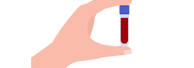 Mobile Blood Draw Services - Laboratory testing at your house
